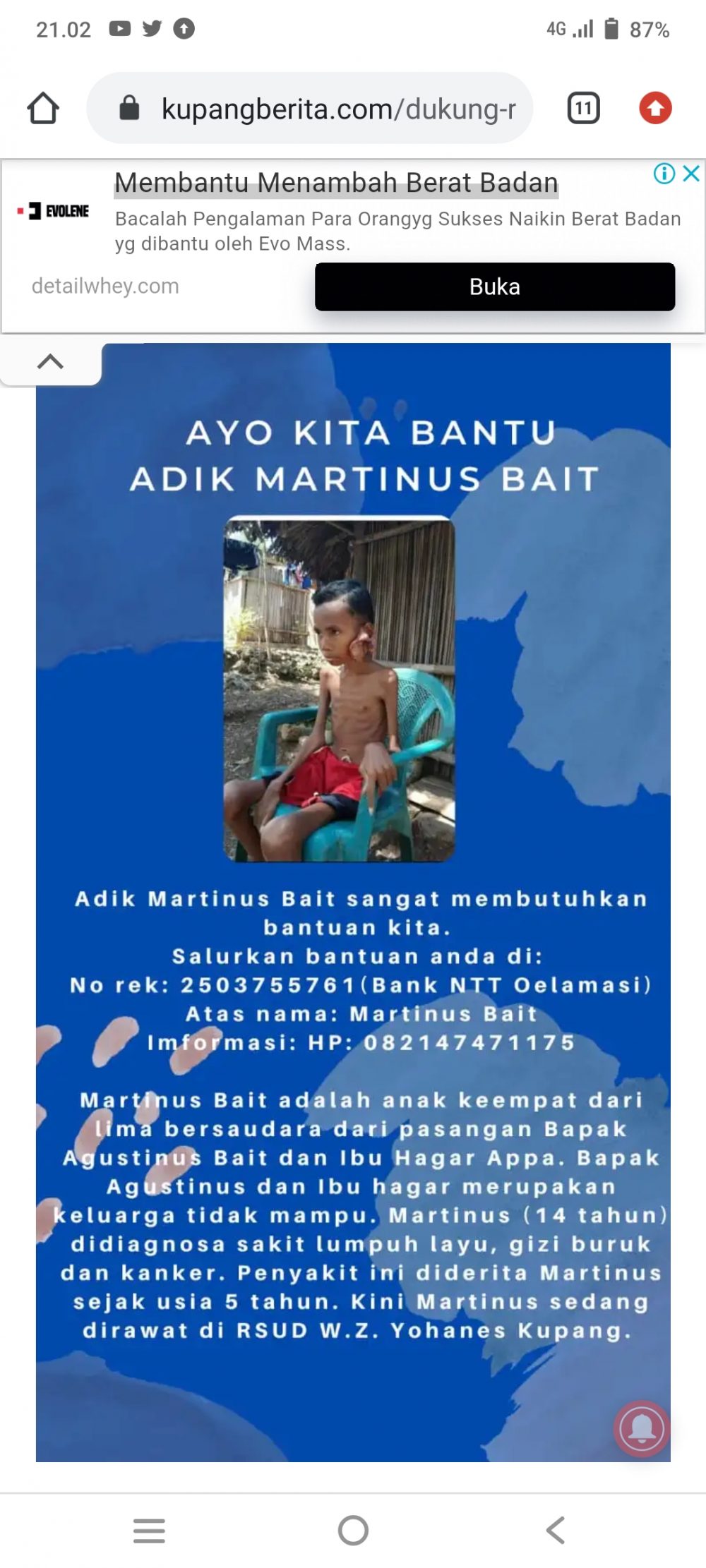 Foto.Martinus Bait, bocah penderita kanker asal Kabupaten Kupang, butuh uluran tanggan.