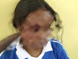 Siswi SMA Negeri Kota Kupang Dibegal Brutal di Jalan Setapak: Pingsan Bersimbah Darah, Pelaku Masih Misterius