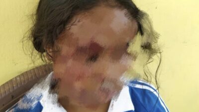 Siswi SMA Negeri Kota Kupang Dibegal Brutal di Jalan Setapak: Pingsan Bersimbah Darah, Pelaku Masih Misterius.