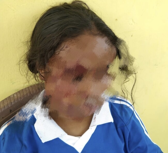 Siswi SMA Negeri Kota Kupang Dibegal Brutal di Jalan Setapak: Pingsan Bersimbah Darah, Pelaku Masih Misterius.